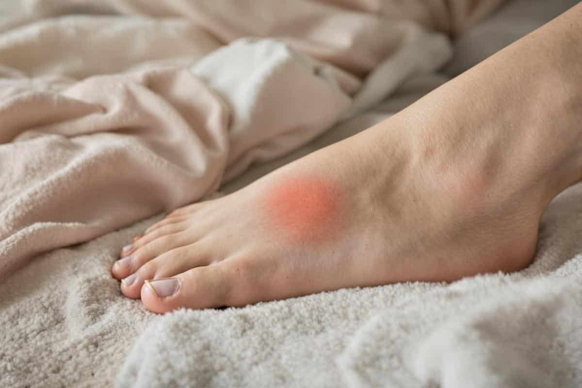 douleur sur le dessus du pied d'une femme vue de prés