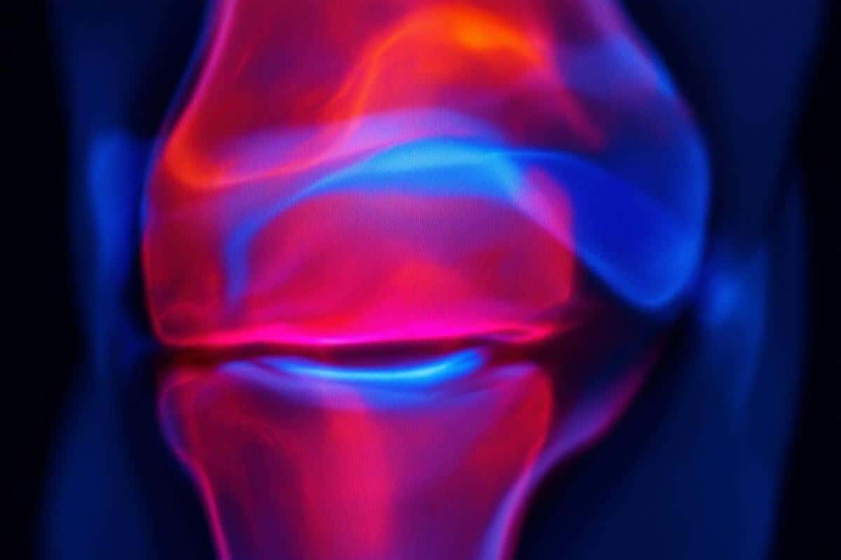 Œdème osseux du genou : causes, diagnostic et traitements